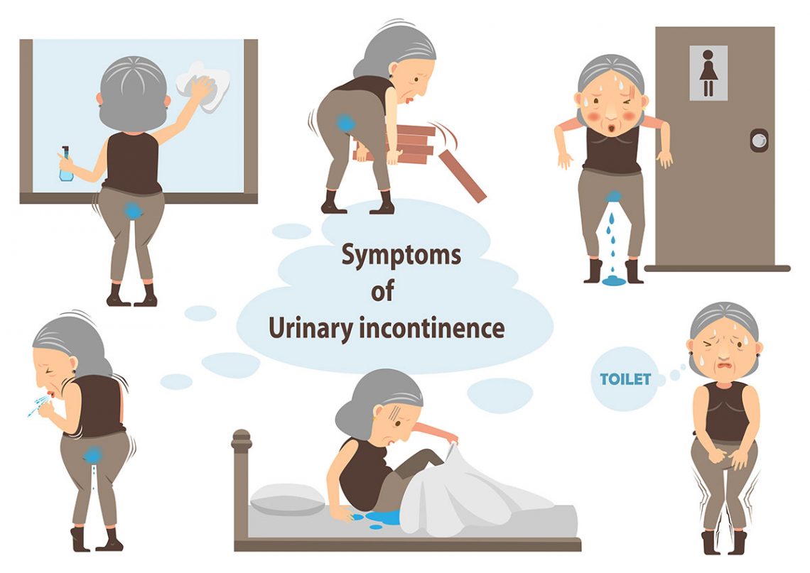 urinary incontinence PhysioCraft