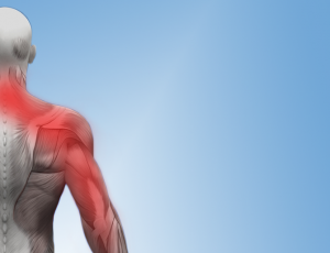 Solutions for Neck and Arm Pain